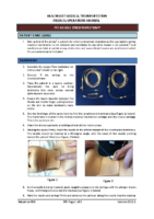 7F5 Needle Cricothyrotomy